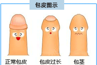 包皮多长算长?